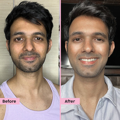 Guava Glow Regime with Cleanser & 10% Vitamin C Serum for Superbright Glow