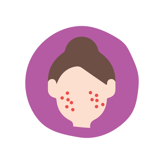  Acne marks reduction image 