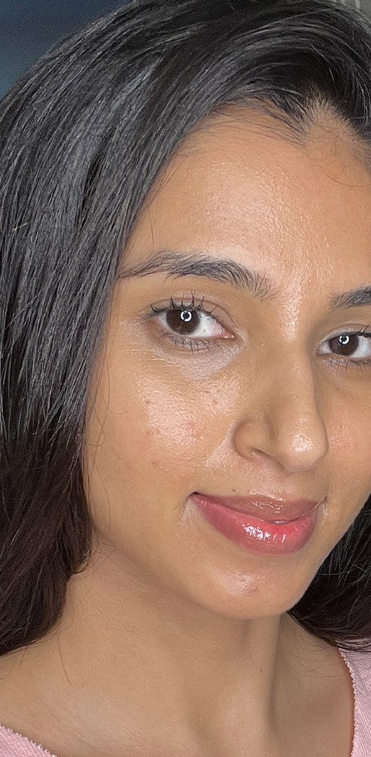 Skin becomes clear with consistent use